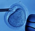 Швейцарцы проголосовали за легализацию диагностики эмбрионов