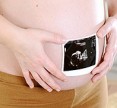 Уникальный тест позволит выявить гипертонию у беременных раньше появления симптомов