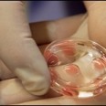 A Product to Improve IVF Embryo Implantation Rates from University of Adelaide