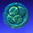 Egg (oocyte) donation