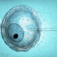 Research On Factors Influencing IVF Success