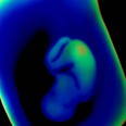 Embryotic Development In The Limelight