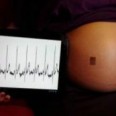 «Электронная татуировка» обеспечивает мониторинг за состоянием беременных